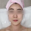 부산 서면 윤곽관리 피부관리 물방울초음파 후기 [카마에스테틱]