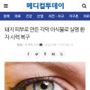 돼지 피부로 만든 각막 이식물로 실명 환자 시력 복구 이미지