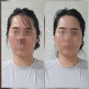 구암로49길 | [칠곡피부관리] 칠곡구암동 작은얼굴바른몸매에서 두골피 받은 후기