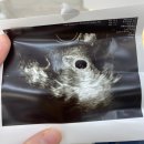 해주병원 | [20대 시험관]강남차병원 동결배아이식 5일배양 감자...의원/해주냉면 수지점/난저 배아이식/배아 이식후기