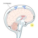 감기와 비슷해 뇌수막염은 어떤병? 이미지