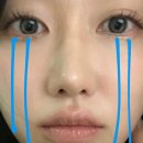 Carven 안경테 + 양면비구면렌즈 후기