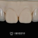 훈 기공소 이미지