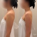 청담솔루션의원 | 디유 에스테틱 프리베 청담점 팔뚝 청담 신부관리 대만족 후기