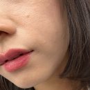 양이멍이 | 홍대피부과 저속노화 자가 줄기세포 뱀파이어 주사 + LDM 내돈내산 후기 !!