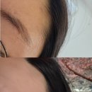 신창중학교 | 광주왁싱 신창동 헤어라인 왁싱 [썸머뷰티] 슈가링 관리방법 후기