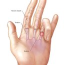 마디케어 이미지