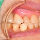 로이치과기공소 이미지