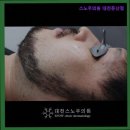 스노우의원대전둔산 | {대전,둔산동,피부과,추천} 스노우의원 대전둔산점 대전 둔산동 피부과 추천