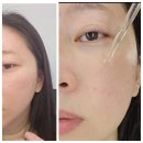 비노트 물톡스 후기 아는 동생 찐 추천템으로 일주일 만에 화장 잘 먹는 피부 완성 (전/후 사진)