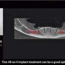 웰컴치과기공소 이미지