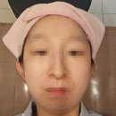 센텀시원정형외과의원 | 센텀피부과 부산 프락셀 엑소좀 모델링팩 솔직 후기 1에서 6일차 경과 모공 피부결 고민 끝