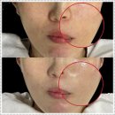 명성메디칼 | 이대입구 피부관리 블레싱스킨케어 고민 끝 완벽 선택 후기