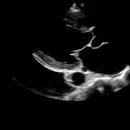 엔도소노 이미지