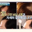 마스터가발 김호증모 영등포