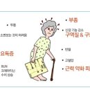 우신장