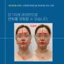 들창코 본점 | 신정동피부관리실, 턱비대칭 바로 잡으니, 얼굴형이 이렇게 달라진다고?
