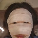 리즈멍 | 스킨부스터 리즈네 2cc 후기 리쥬란 VS 리쥬란 HB플러스 VS 리즈네 비교 차이점