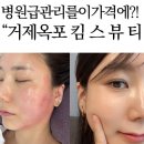 킴스테라피 | 거제 옥포 킴스뷰티 '플라모드 트리플 테라피', 이건 정말 병원급 그 이상!(거제에스테틱)