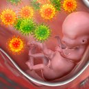 141-4-000055 이미지