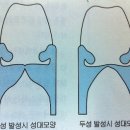 발성