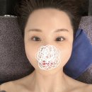 한중약국 | 대구 대명동 피부관리 한번으로도 효과보는 라플러스에스떼
