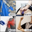 회전근개파열 비수술치료만으로 완치한 후기 (+효과본 치료법)