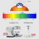 파티마안경 | 창원 파티마안과 [창원 스마일라식] 내돈내산 후기