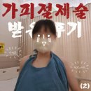 반도병원 | [SSUL] 대구 화상병원에서 2도 화상 수술 경과 후기 (2)
