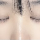 디데이성형외과의원 네이버블로그