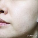 비타케어 이미지