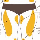 씨스투(CS2)에스테틱 이미지