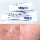 차부약국 | 주사피부염 수란트라 한달차 후기 | 붉은기•트러블 진정 변화