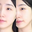 메디엑스퍼트 | 센텔리안24 마데카PDRN크림 &amp; 360도샷 액티브세럼으로 느껴본 PDRN 효과