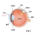 아이데코 안경콘택트 이미지