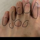 엘린플러스 | 엘린플러스 크림, 트리마졸 크림 항진균제 칸디다 질염, 무좀, 한포진, 두드러기 크림 후기