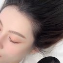 탑헤어라인 이미지