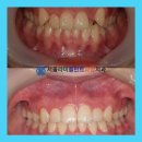 서울라미플란트치과교정과치과의원 이미지