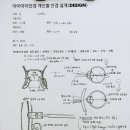 개인별 안경 설계 - 사례 6. 커뮤니케이션과 블루라이트 차단 안경. 이미지