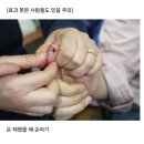 의사들은 플라시보 효과라고 하지만 실제로 효과를 본 사람들은 너무 많은 민간요법.jpg 이미지