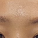 아드네 | 창원 에스테틱 아드딸뷰티 여드름관리 비립종 압출 문제성 피부관리 방문 후기