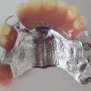 다윗치과기공소 이미지