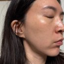 바이퓨어 | 원바이퓨어 스파시카앰플 여행후기 시카앰플세럼 세럼추천 앰플추천 솔직리뷰