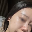 대구 월성동 피부관리 스파블레쥬 라라필 후기