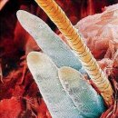 [정보] 놀라지 마십시요!! 피부트러블 일으키는 모낭충 없애는 방법!! 이미지