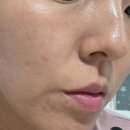 프라임 | 뷰티디바이스 센텔리안 마데카프라임 내돈내산 후기