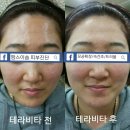 팜스테라 이미지