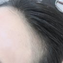 뷰티헤어라인 네이버블로그