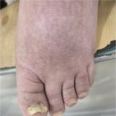 지에스25 대전지식센터점 | 대전 둔산동 발톱무좀 잘하는 곳 찾는다면 페디쿱스 페디쿱스 동성풀리메디