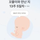 상사보건소 | 13주, 14주, 15주, 16주 증상 / 아이폰으로 심장소리 듣기 / SC제일산부인과 16주 2차 기형아 검사...